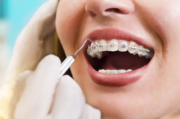 ortodoncia dental