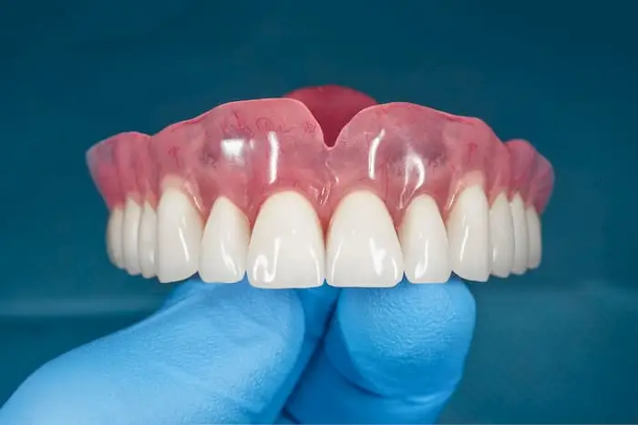 aclaramiento de dientes manchados